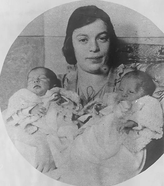 Americas Siamese Twins. Mrs Meyer Zarelzky, of New York City, with her