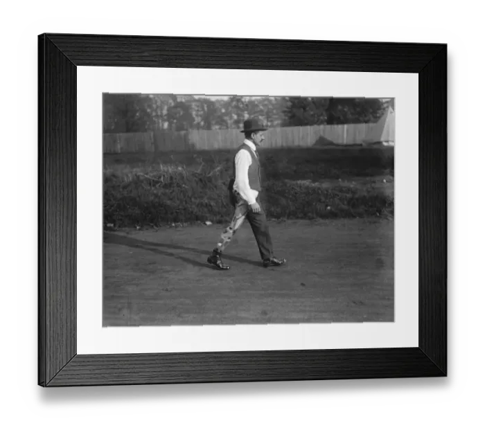 Framed Print : Ministry of Pensions artificial limb factory at Thames Ditton. One of the workmen Framed Print : Ministry of Pensions artificial limb factory at Thames Ditton. One of the workmen