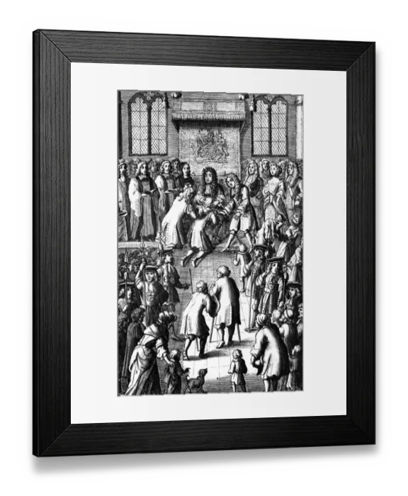 Framed Print : Charles II healing the Kings Evil by the Royal Touch John Browne, Adenochoiradelogia Framed Print : Charles II healing the Kings Evil by the Royal Touch John Browne, Adenochoiradelogia