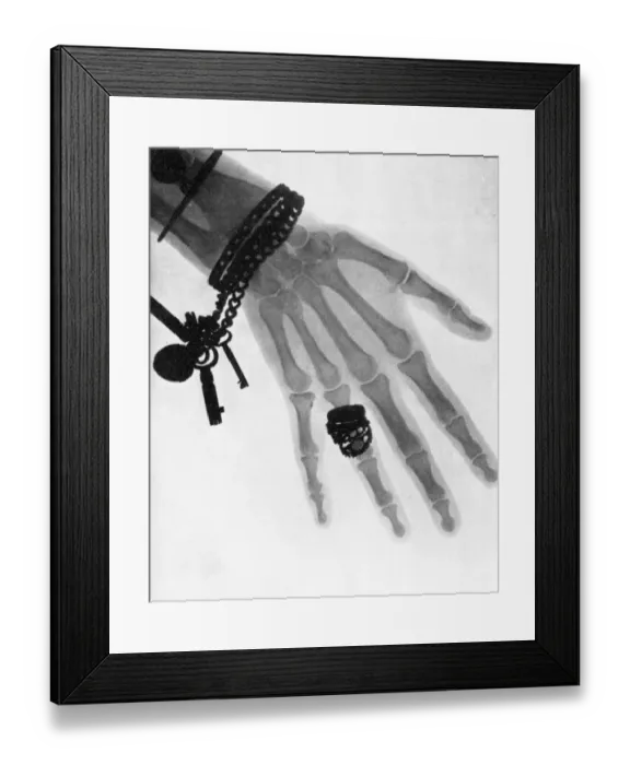 Framed Print : Early English x-ray c. 1896, 1897 Framed Print : Early English x-ray c. 1896, 1897