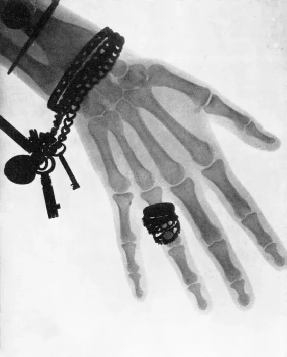 Framed Print : Early English x-ray c. 1896, 1897 Framed Print : Early English x-ray c. 1896, 1897