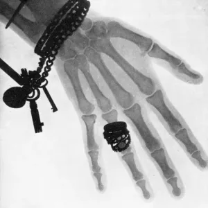 Early English X-ray Print c. 1896-97 Early English X-ray Print c. 1896-97