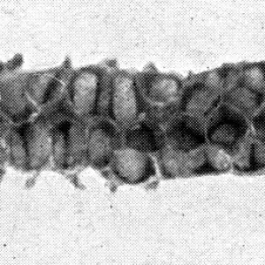 The Queens Eggs : Legs as pollen carriers : the making of combs : Bees
