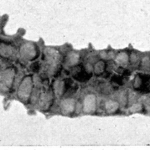 The Queens Eggs : Legs as pollen carriers : the making of combs : Bees